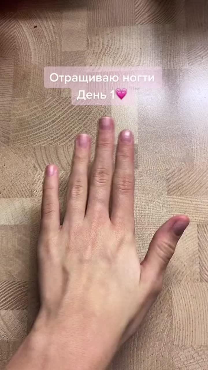 лайки: 411.8k.комментарии: 3373.видео в от пользователя отращиваю ноготки💅💗 (@regrowth.nails): «❗️йод наносить не больше 2-3 раз в неделю❗️если есть вопросы , то пишите в комментарии💗)))#отращиваюногти #ванночкадляногтей #ногти #какотраститьногти #elbruso #какукрепитьногти #rge #рекомендации».grow nails. l o v e g a m e - ➷｡˚𝐬𝐚𝐯 ೃ࿔₊.